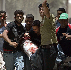 20061123054238-00-palestinos-heridos-archivo.jpg